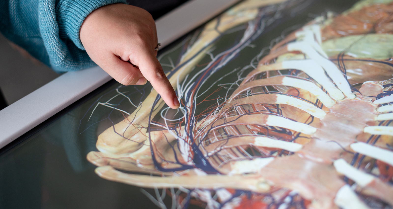 Finger pointing at medical diagram